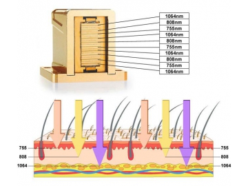 Máquina de depilación láser con longitud de onda 3-KM400D