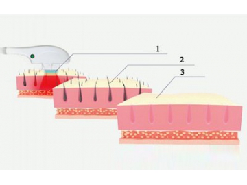 Depilación SHR/OPT/AFT,  Depiladora con Sistema SHR/OPT/AFT