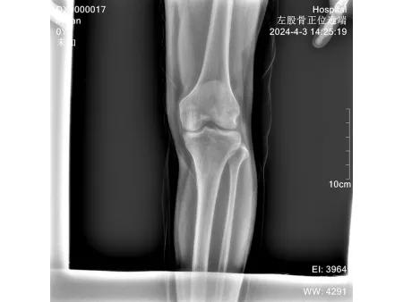 Equipo de Rayos X, Portátil DELUXE