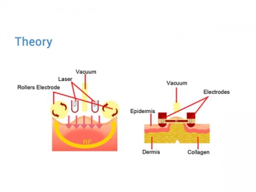 Máquinas modeladora del cuerpo por cavitación de vacío VS 